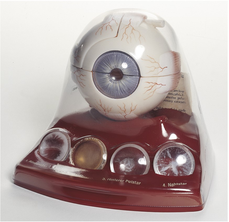 CS22 Oko - Somso Modelle: Model oka se šedým zákalem, 3x zvětšeno
