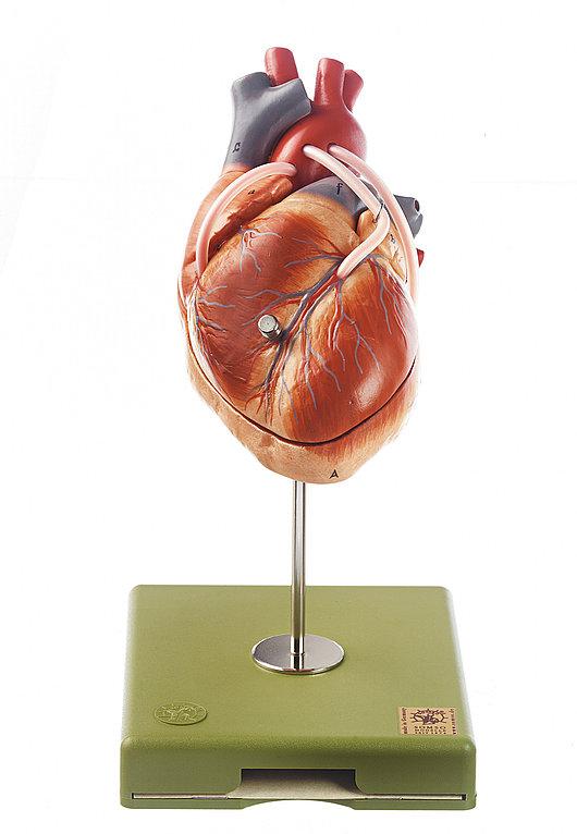HS15-1-1 Srdce, oběhový systém - Somso Modelle: Srdce s bypassem, skutečná velikost, 2 díly