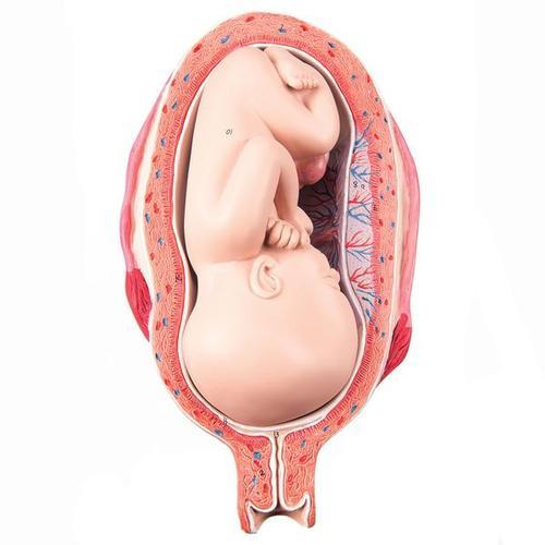 L10-8-1 Těhotenství, porod - ostatní: Plod 7. měsíc