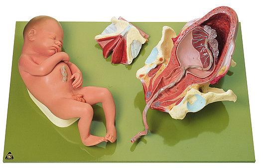 MS45-3-1 Těhotenství, porod - Somso Modelle: Porod, třetí fáze