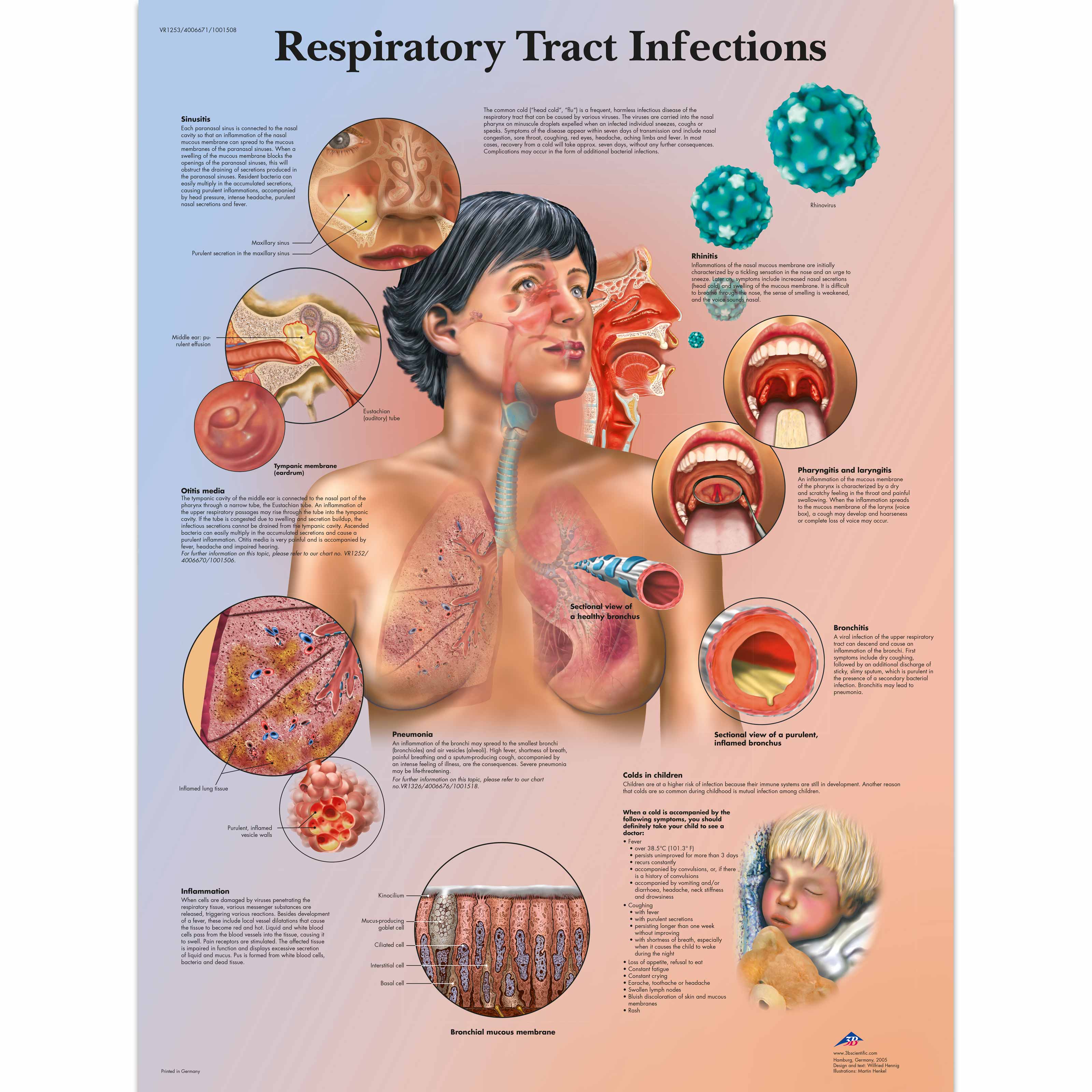 VR12538 Anatomické obrazy: Infekce dýchacích cest