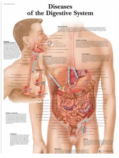 Výstřižek1729 Anatomické obrazy: Obraz - Onemocnění trávicí soustavy