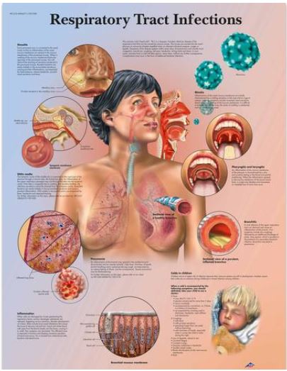 Výstřižek20 Anatomické obrazy: Obraz - Infekce dýchacích cest