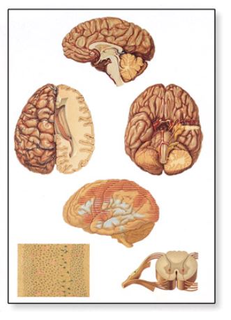Výstřižek2493 Anatomické obrazy: Obraz - Obraz - centrální nervová soustava, 84 x 118 cm