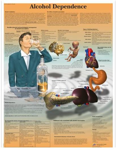 Výstřižek5557 Anatomické obrazy: Obraz - Graf závislosti alkoholu, papír, 50x67cm
