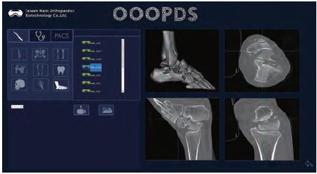 Asclepius radiologický prohlížeč