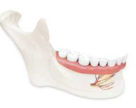 01-81-578 Zuby a čelist: Model dolní čelisti, 6 dílů