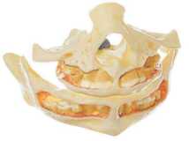 01-81-597 Zuby a čelist - Somso Modelle: Chrup dospělého člověka (plně odhalené), 2 díly