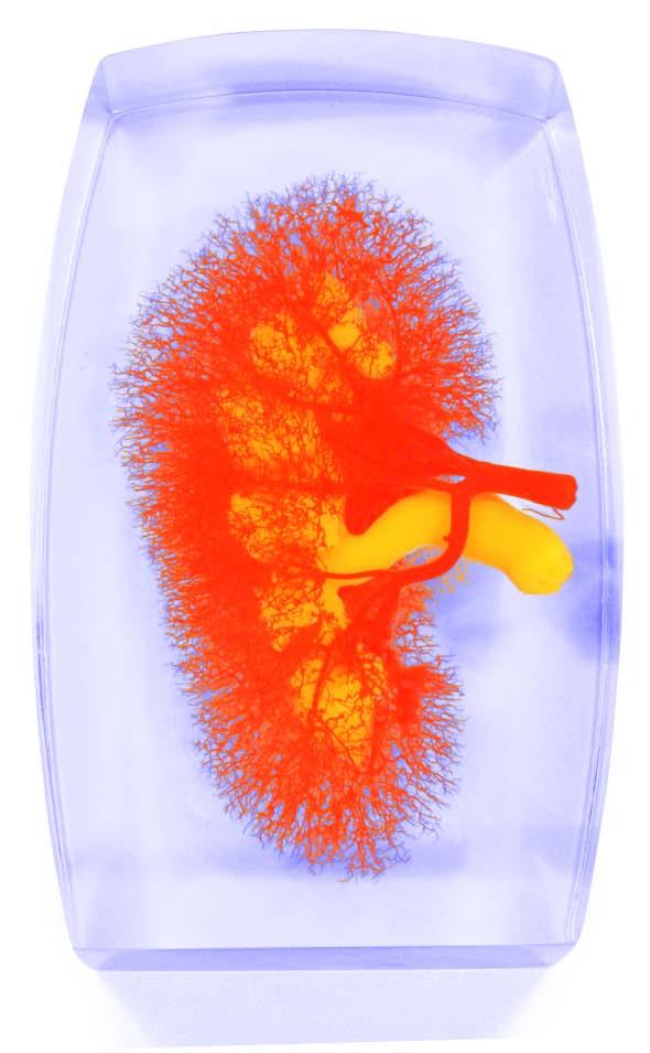 01-82-176 Ledvina, močový systém: Model ledvinných cév (červeno