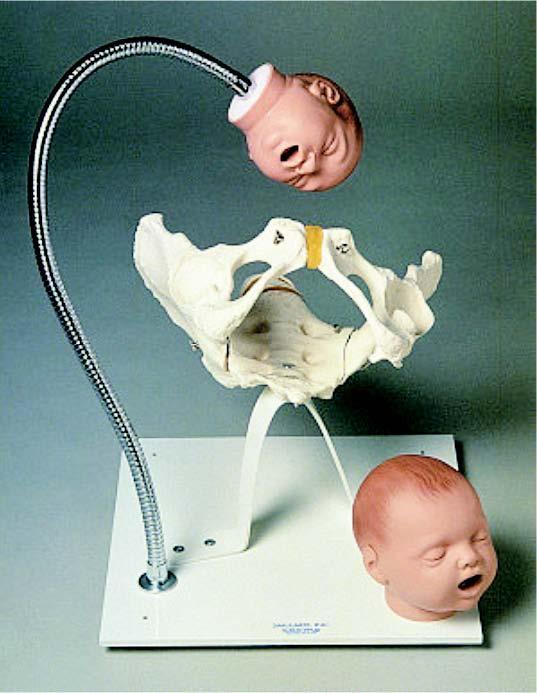 01-82-285 Těhotenství, porod: Kostra pánve s hlavami plodů na stojanu