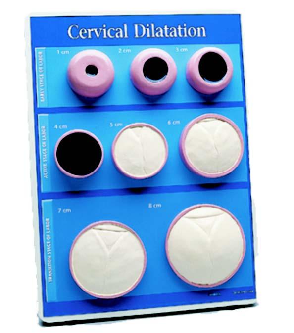 01-82-287 Těhotenství, porod: Model cervikální dilatace