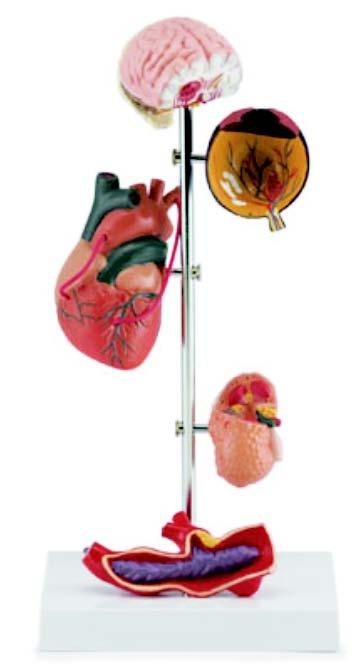 01-82-78 Srdce, oběhový systém: Model hypertenze, 7 dílů