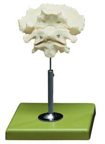AM150-0407 Kosti, části kostry - Somso Modelle: Atlas, axis a šupinatá část týlní kosti