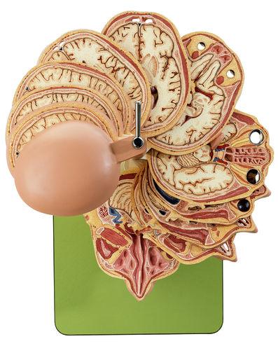 BS5-5-1 Hlava - Somso Modelle: Anatomický sekční model hlavy (kombinace s odpovídajícími MR snímky), 10 dílů