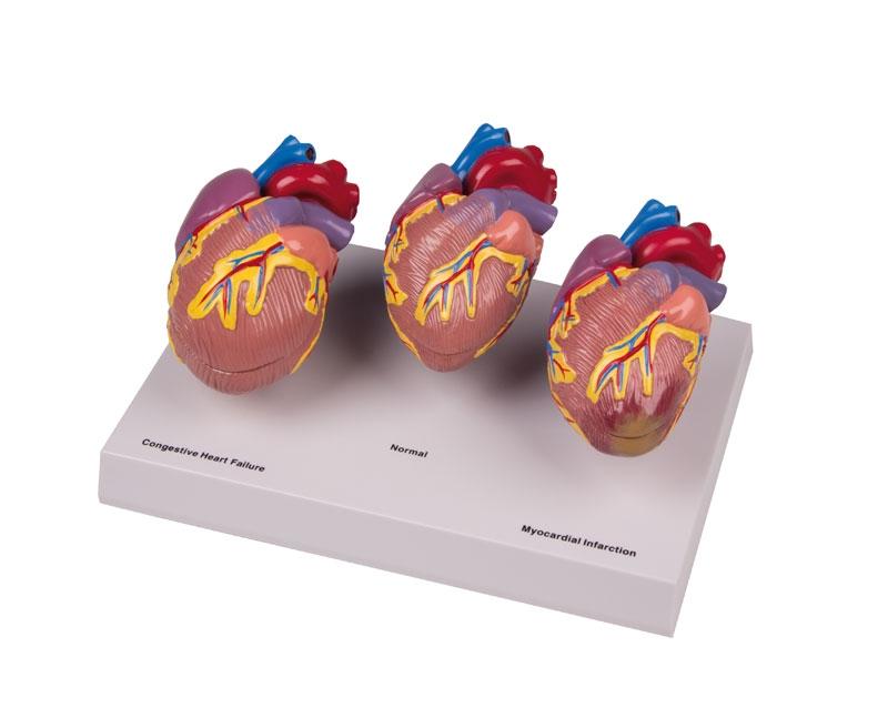 EM270-G70 Srdce, oběhový systém: Model chorob srdce