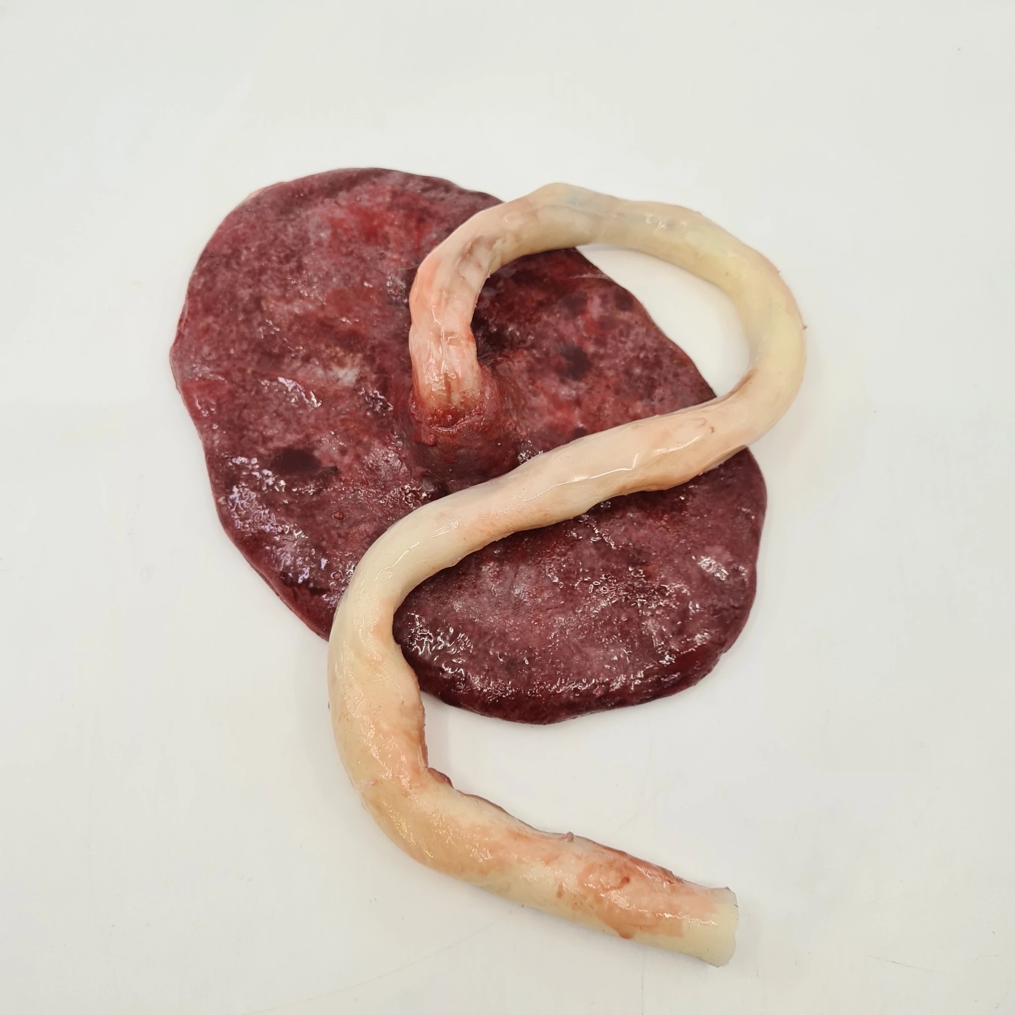 MO7209 Těhotenství - návleky: Placenta s pupeční šňůrou