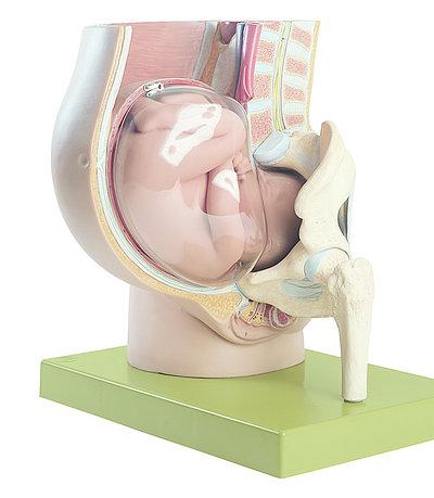 MS13-1-1 Těhotenství, porod - Somso Modelle: Pánev s dělohou v 9. měsíci těhotenství, skutečná velikost, 4 díly