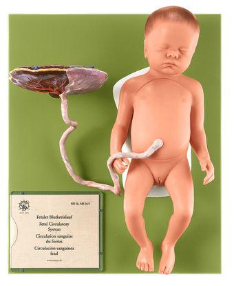 MS16-1-1 Těhotenství, porod - Somso Modelle: Fetus, holčička, skutečná velikost, 13 dílů