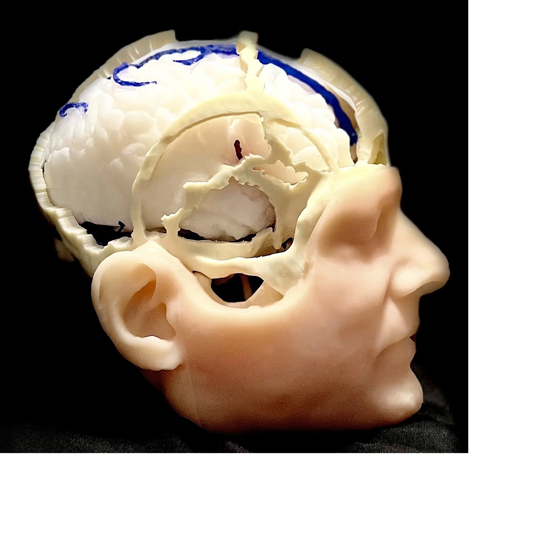 N-T-6 Neurochirurgické modely: Simulátor transkraniálních přístupů