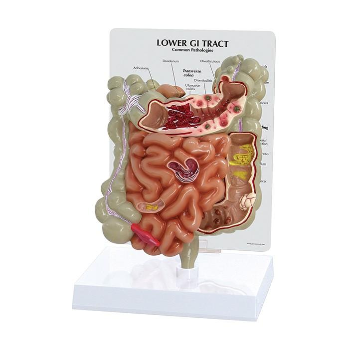 OS205-50350 Trávící soustava: Model gastrointestinálního traktu