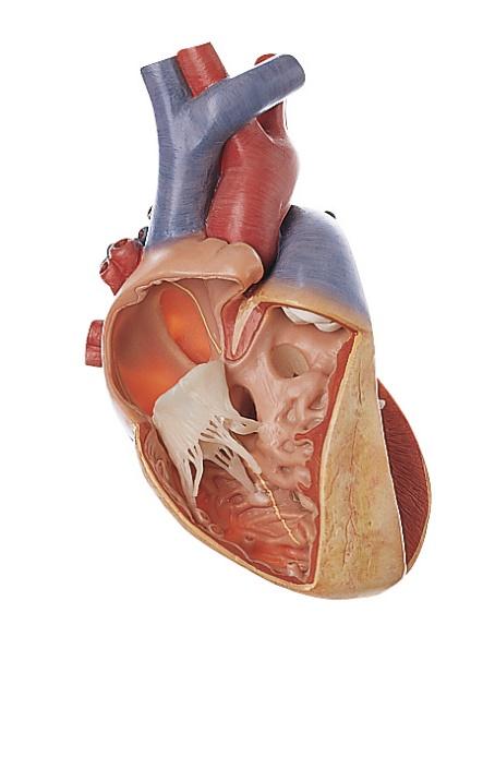 OS7-3-1 Srdce, oběhový systém - Somso Modelle: Různé defekty komorového septa