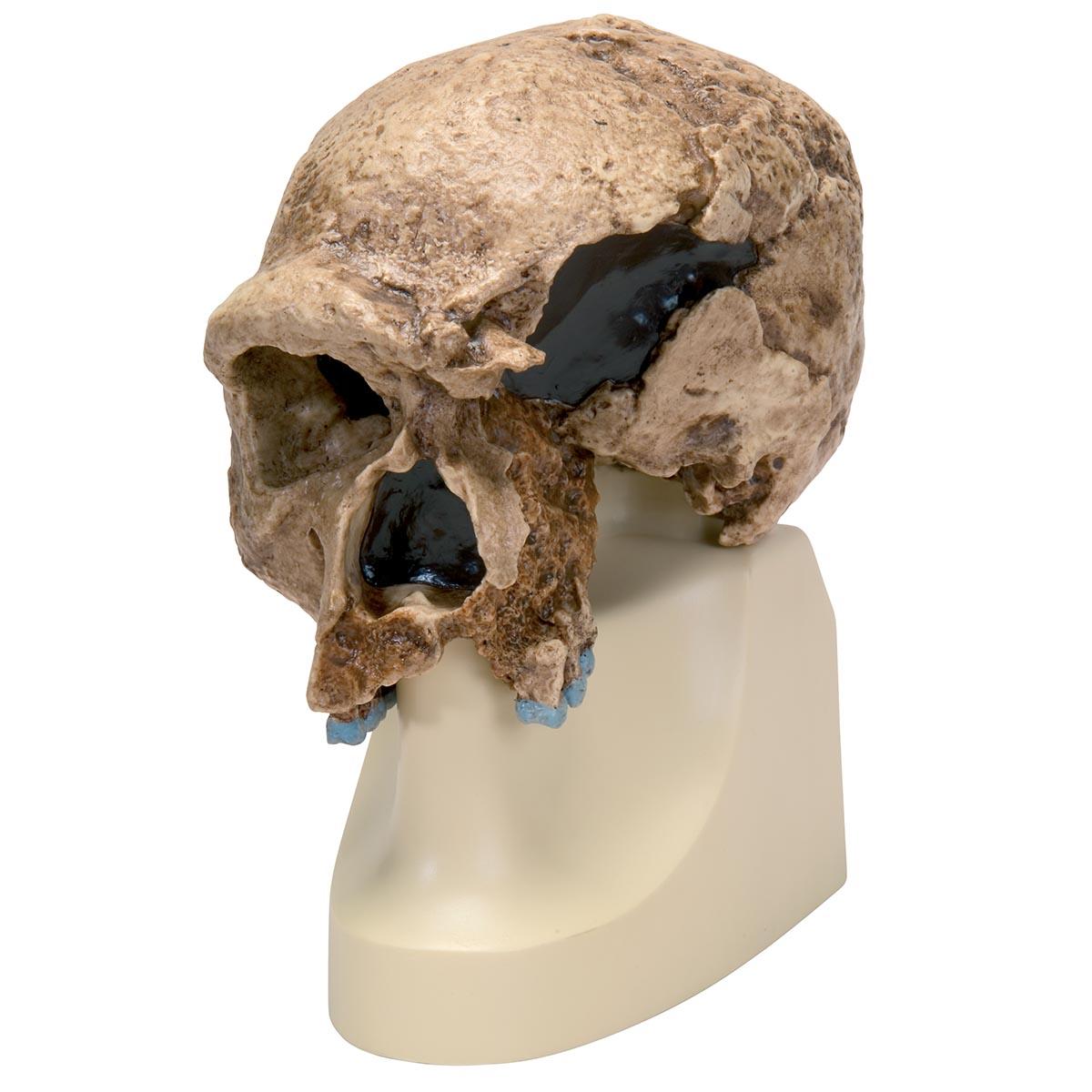 VP753-1 Lebka: Antropologické modely lebky - Homo steinheimnensis Skull (Berkhemer, 1936)