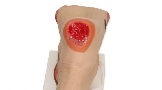 0950-heal-stage3-1000x1000
