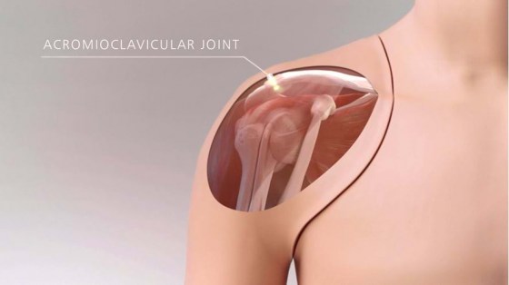 70202_ultrasound_shoulder_img_web_04