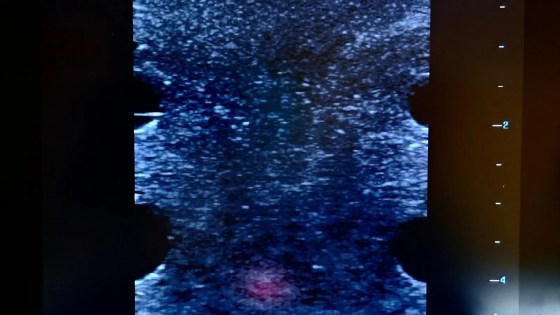 ARB3