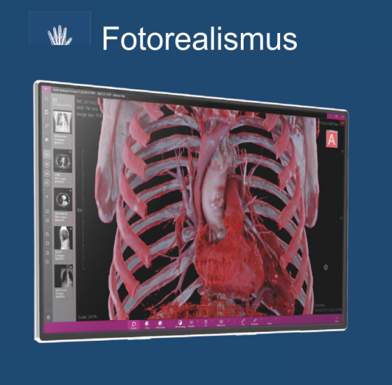 AthenaHUB-fotorealismus