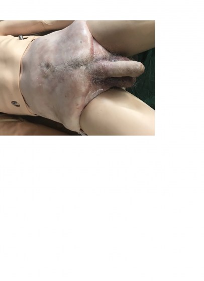 MM595-1