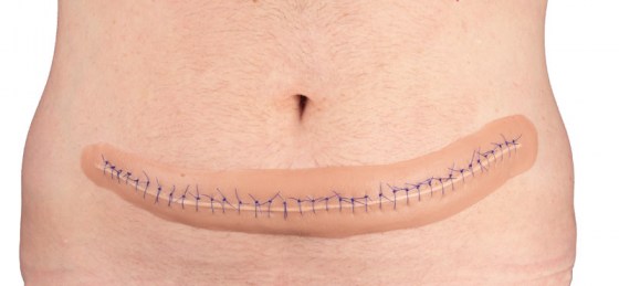 PW009B_3obJ3lP8giqB6j