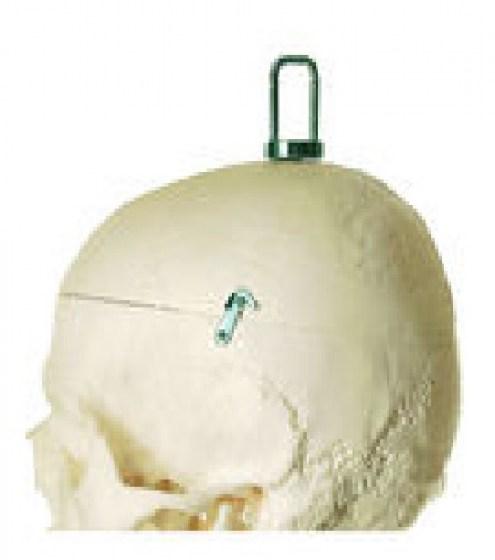 QS10-11-2
