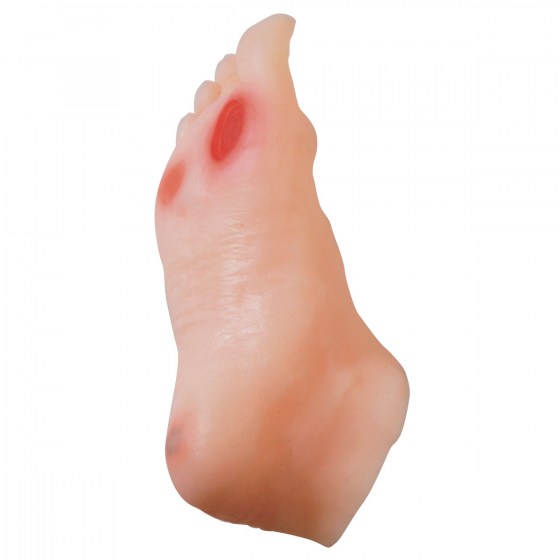 W43107_02_1200_1200_Diabetic-Foot-Model