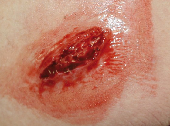 WS01_WS03_3_1g7fHxPOE3bE94