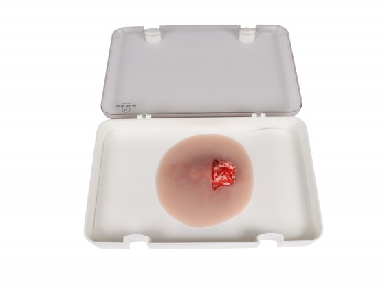 Wunddarstellung_offene_Fraktur_Sprunggelenk