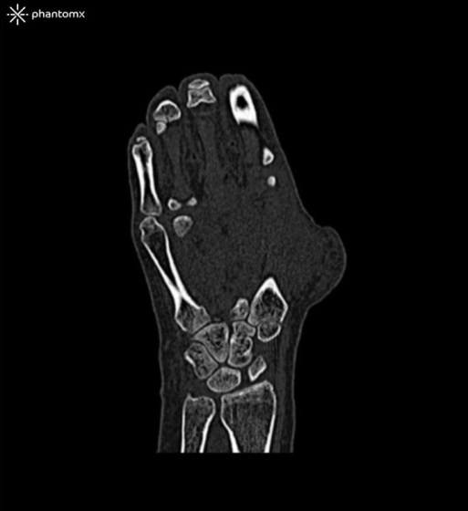 nlp1300a